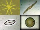 Great Lakes phytoplankton species viewed under a microscope.
